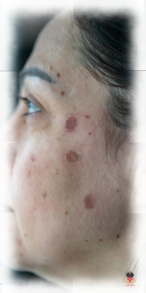 Dermatologist in West Delhi for Skin, Hair and Nail Care