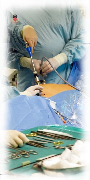 Laparoscopic Surgery & Surgeon Doctor in West Delhi
